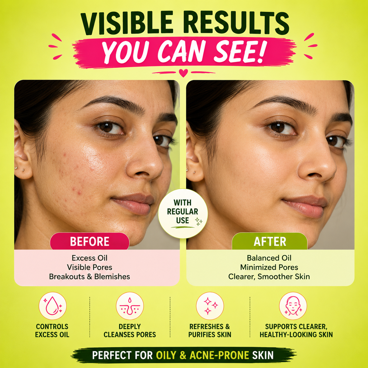 Sarwamveda Oil Balancing Clay Mask | Neem + Triphala + Multani Mitti | 100g